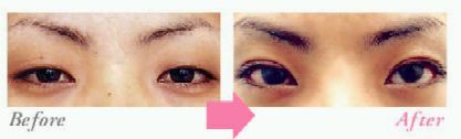 �ځiBefore&After�j