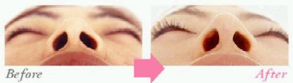 �@�iBefore&After�j