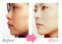 �A�S�iBefore&After�j