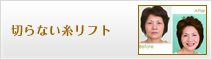 切らない糸リフト