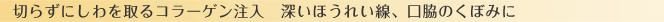 �ڤ餺�ˤ�����륳�顼���������������ۤ��줤�������ƤΤ��ܤߤ�