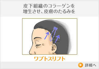 ワプトスリフト