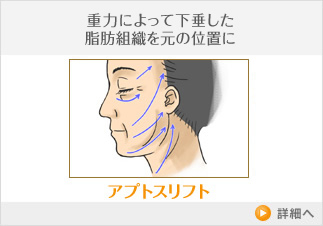 アプトスリフト