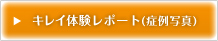 キレイ体験レポート(症例写真)