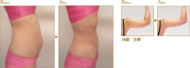 Before After