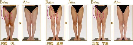 Before After