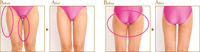 Before After