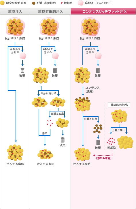 従来の脂肪注入法との違い