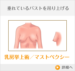 乳房挙上術/マストぺクシー