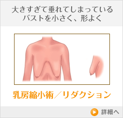 乳房縮小術/リダクション