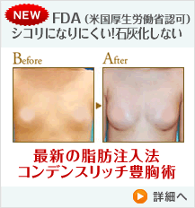 最新の脂肪注入法 コンデンスリッチ豊胸術