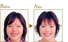 Before After