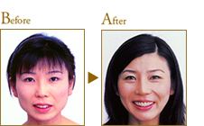 Before After