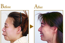 Before After