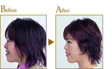 Before After