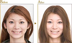 Before After