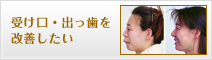 受け口・出っ歯を改善したい