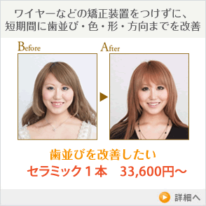 歯並びを改善したい