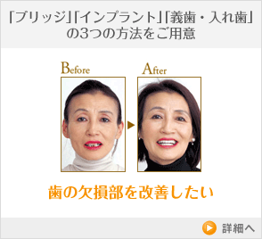 歯の欠損部を改善したい