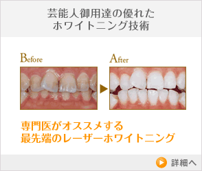 歯の色を改善したい