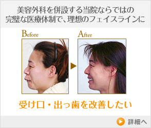 受け口・出っ歯を改善したい