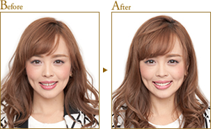 Before After