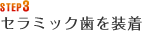 STEP3 セラミック歯を装着