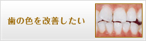 歯の色を改善したい