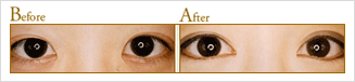 Before After