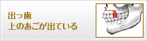 出っ歯 上のあごが出ている