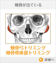 頬骨が出ている