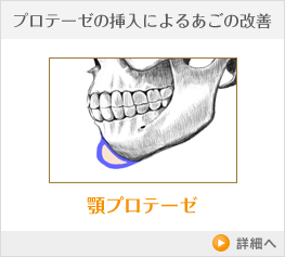 プロテーゼの挿入によるあごの改善 顎プロテーゼ