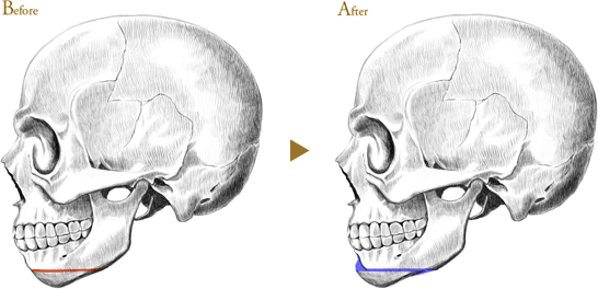 Before After