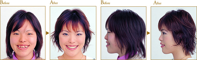 Before After
