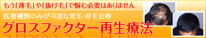 毛髪再生治療