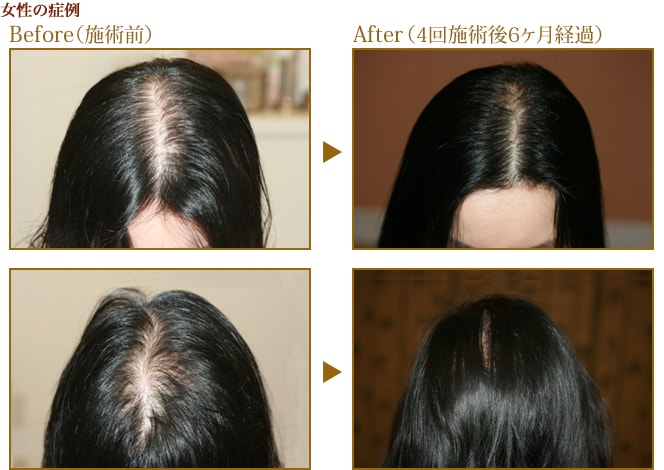 女性の症例