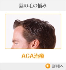 髪の毛の悩み AGA治療