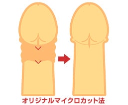 オリジナルマイクロカット法とは?