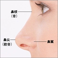I字型インプラント