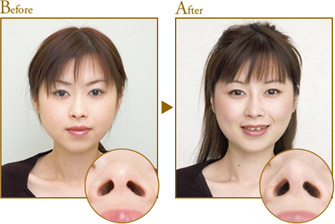 Before After