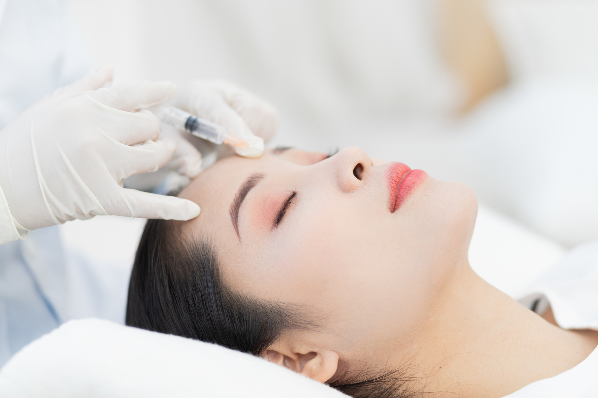 アラガン製 ジュビダーム ウルトラXC