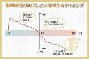 脂肪吸引で細くなったと実感するタイミング