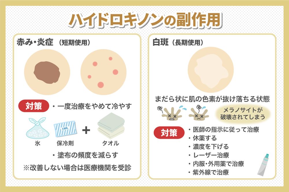 ハイドロキノンの副作用