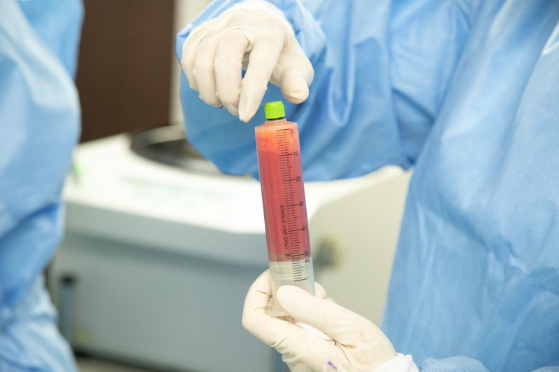 吸引した脂肪を処理する医師