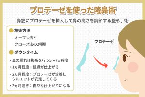 プロテーゼを使った降鼻術