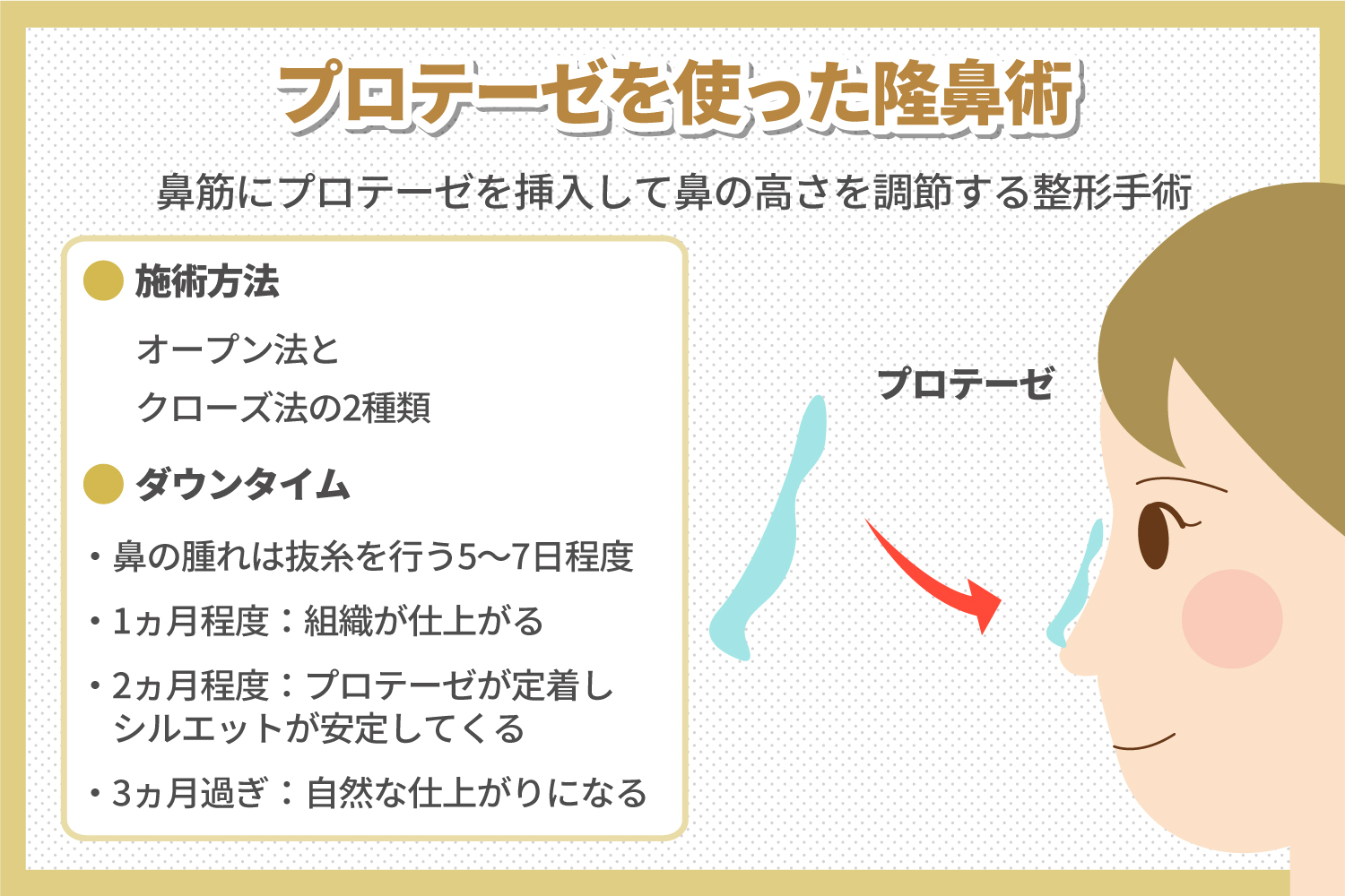 プロテーゼによる隆鼻術は痛い？痛みが引かない時の対処法などを解説
