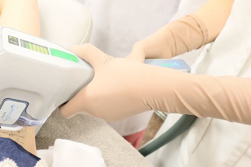 ワキガ治療で使用するミラドライのデメリットやメリットを解説！