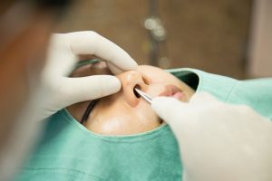 鼻にプロテーゼを挿入するために鼻を切開している