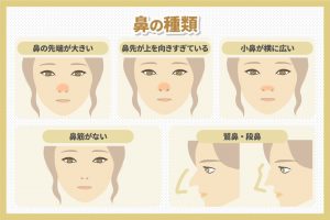 鼻の種類