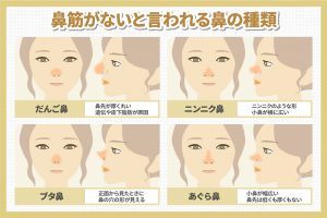 鼻筋がないと言われる鼻の種類